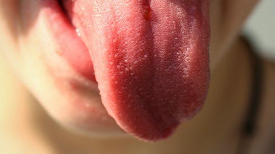 Textura limbii indică lipsa unor vitamine din organism sau existenţa unor boli