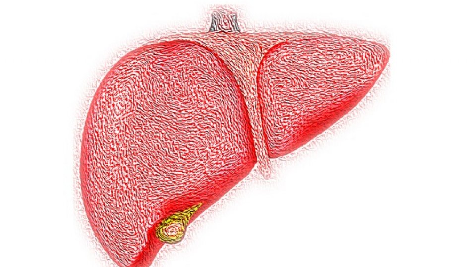 Boala hepatică: în creștere la copii