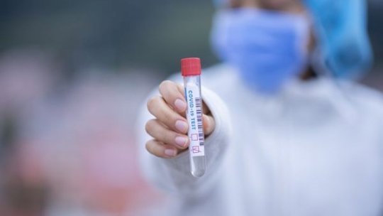 Un om de ştiinţă sârb a dezvoltat un test împotriva noului coronavirus, mai fiabil decât PCR