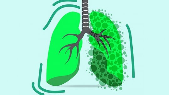 Caravană mobilă de depistare activă a tuberculozei