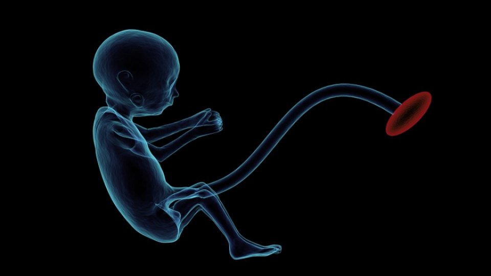 Noul test ADN pentru trisomia 21 ar putea înlocui actuala formă de screening