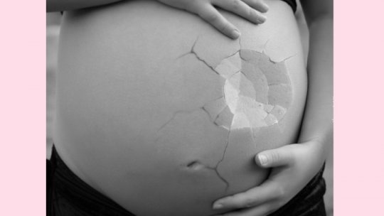 Preeclampsia - o boală frecventă și uneori foarte gravă a femeii gravide