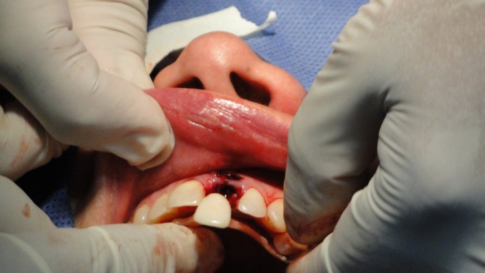 România duce lipsă de medici stomatologi