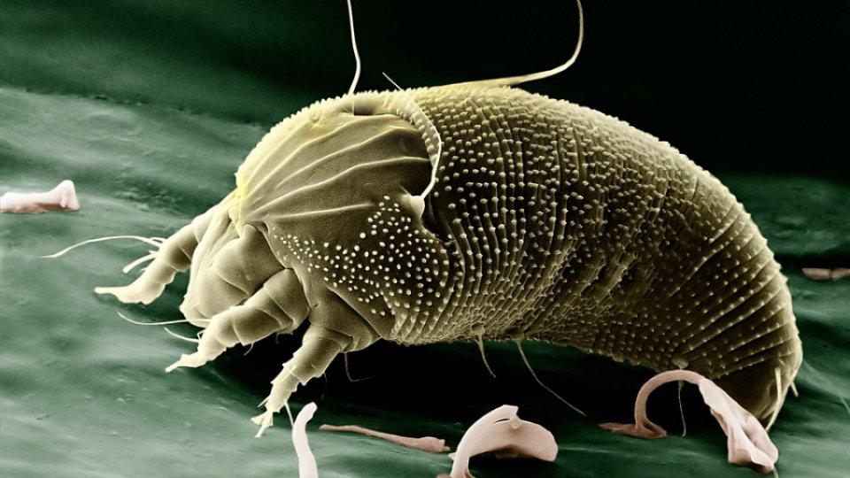 Alergiile de contact: reflexele potrivite