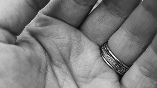 Pompierii, chemaţi să taie verigheta de pe degetul unui bărbat