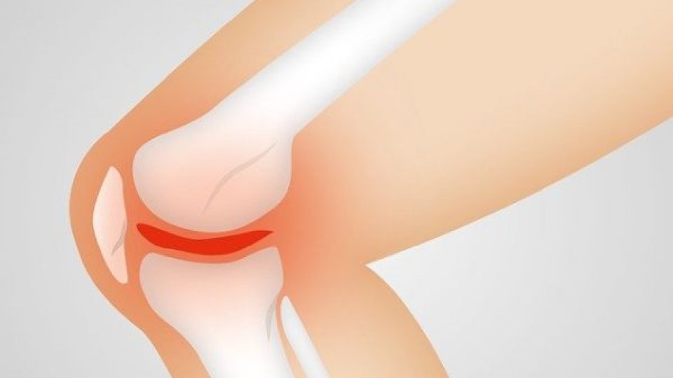 Durerile de genunchi: Care sunt cauzele apariției și cum poți trata problema