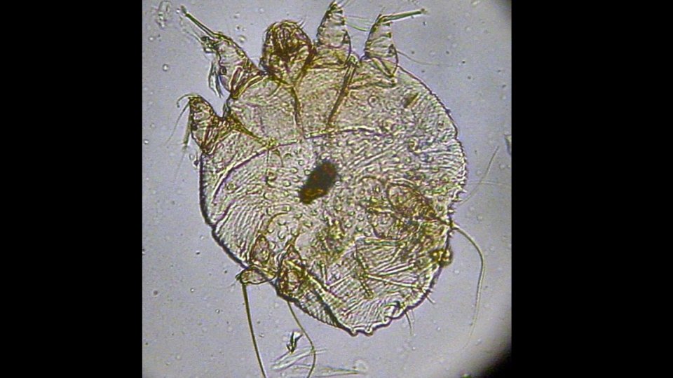 Pecinginea și scabia, infecții transmise prin contact