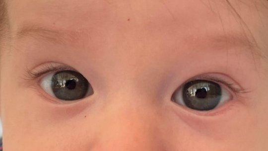 Vitamina D previne problemele mintale la copii