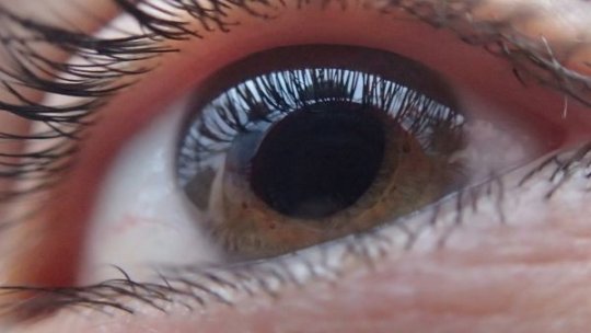 Posibile cauze pentru ochi umflați