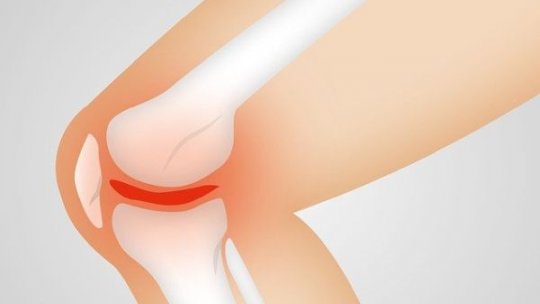 De ce apar durerile de genunchi și cum pot fi tratate eficient