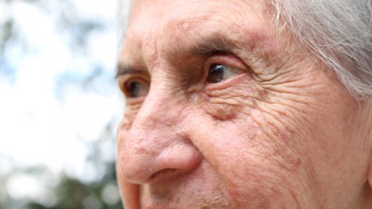 Combaterea ridurilor: peelinguri, lasere sau injecții?