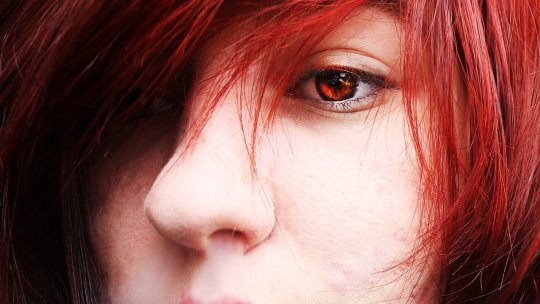 Cearcănele și pungile de sub ochi: soluții fără intervenție chirurgicală