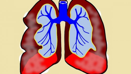 Omega-3 ar putea încetini debutul acestei boli fatale