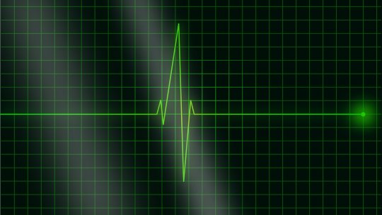 Inimă artificială pentru copii, care poate fi controlată cu o aplicaţie mobilă, creată de studenţii de la Medicină