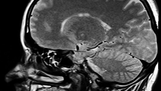 Un animal străvechi, asemănător unui porc, arată începuturile evoluţiei creierului la mamifere