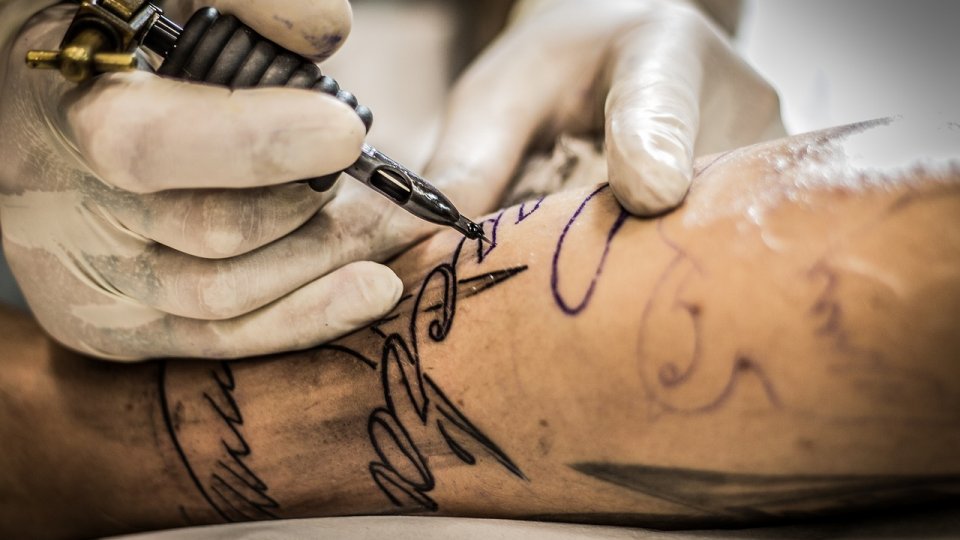 Noua tehnică de îndepărtare a tatuajelor: extrudarea pigmentului