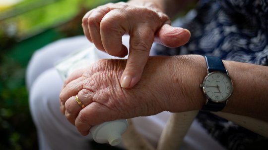 Osteoartrita degetelor. Tot ce trebuie să știi