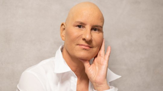 Cancer: de ce chimioterapia duce la căderea părului?