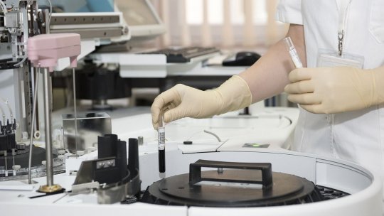 Cercetătorii anunță progrese în diagnosticarea precoce a cancerului ovarian